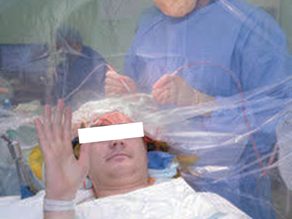 Awake Craniotomy